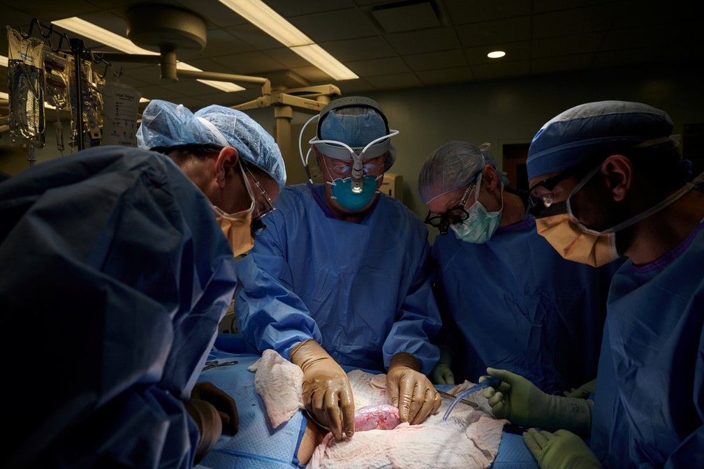 Na foto, não datada, equipe cirúrgica examina o rim de porco em busca de sinais de rejeição. O órgão foi implantado fora do corpo para permitir a observação e amostragem de tecido durante o período de estudo, de 54 horas, na NYU Langone em Nova York, EUA. — Foto: Joe Carrotta para NYU Langone Health/via Reuters