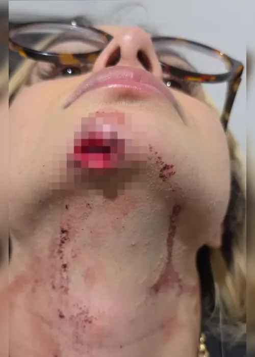 Caso Bárbara Souza: veja nota na íntegra de entidade após influenciadora ser arrastada por ex-companheiro