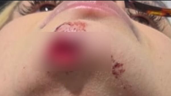 Influenciadora denuncia ex-companheiro por agressão, roubo e afirma que foi arrastada em carro por 100 metros, em Maceió
